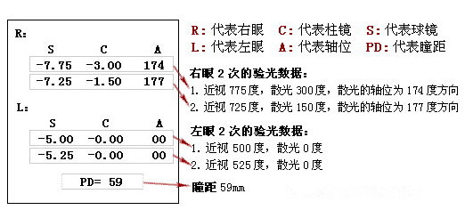 眼科醫(yī)生教你如何一分鐘看懂驗(yàn)光單！